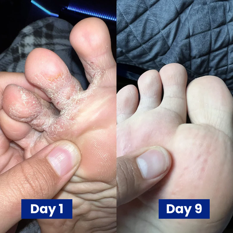 Reboot Labs™ Anti-Fungal Spray for Foot Fungus & Odor