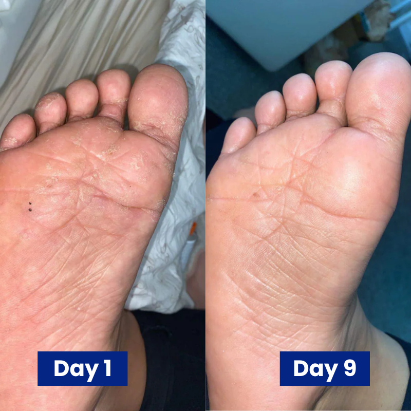 Reboot Labs™ Anti-Fungal Spray for Foot Fungus & Odor