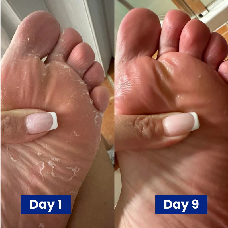 Reboot Labs™ Anti-Fungal Spray for Foot Fungus & Odor
