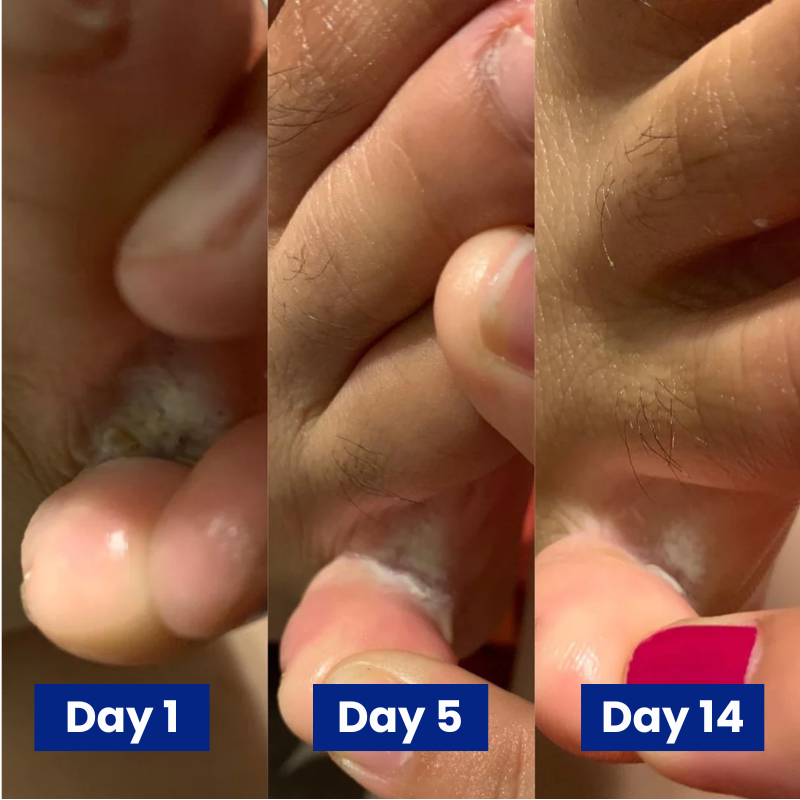 Reboot Labs™ Anti-Fungal Spray for Foot Fungus & Odor